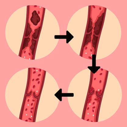 Castaño de Indias: Soporte vascular para mejorar la circulación