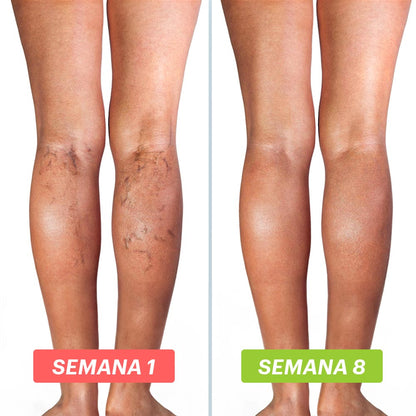 Castaño de Indias: Soporte vascular para mejorar la circulación