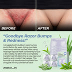 Hydrogel Vajacial Mask for Razor Bumps & Redness Relief