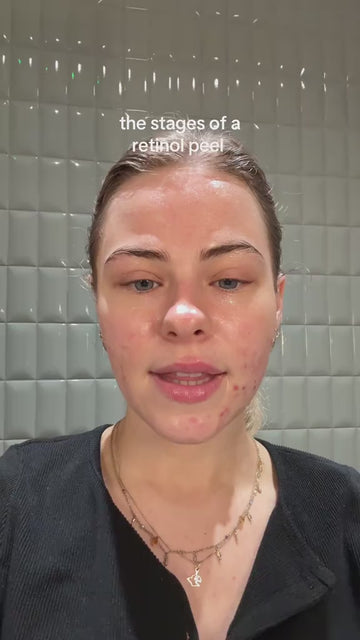 VitaYouth™ Retinol + Peptide Renewal Cream for Smoother-Looking Skin video thumbnail